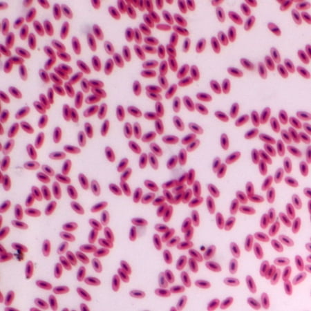 Bird Blood Film  Smear Microscope Slide price history on PriceWatchPro