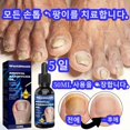 thumbnail image 4 of Tratamiento de uñas para el cuidado de los pies, esencia blanqueadora para los pies, Gel antiinfección para eliminación de hongos en las uñas de los pies, 4 of 5