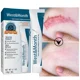 thumbnail image 2 of Crema de eliminación de cicatrices a base de hierbas, Gel quirúrgico para quemar cicatrices, cesárea, crema de tratamiento de estrías, cuidado suave de la piel, 2 of 5