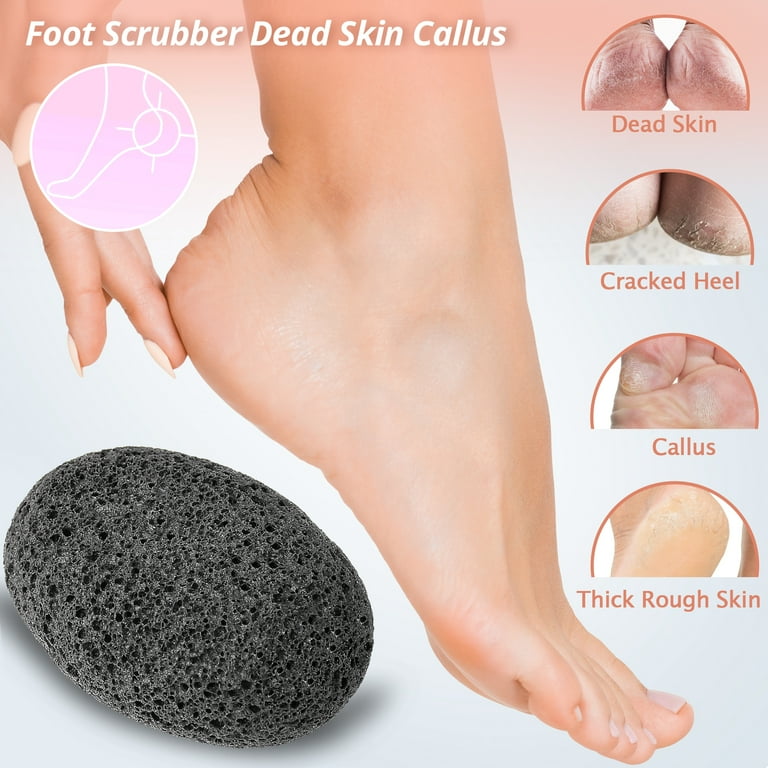 MARYTON Pumice Foot Stone Pcs, Pedicure Scrubber for Callus and