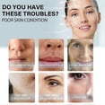 thumbnail image 3 of Hilo de colágeno de seda EELHOE Reafirmante facial Antienvejecimiento Relleno facial Antiarrugas Cosméticos Cuidado de la piel, 3 of 4