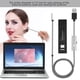 thumbnail image 3 of Herramienta de limpieza de oídos endoscopio de oído digital limpieza de oídos anciano padre para niño ANGGREK Otros, 3 of 8