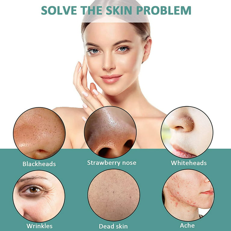 Facial Ultrasonic Skin Scrubber Face Spatulablackhead Remover For Face With  6 Modes, Dead Skin Remover Facial Scrubber Spatula, Blackhead Extractor Fa