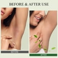 thumbnail image 4 of Exfoliante desintoxicante para axilas SHVYOG, té verde con menta y árbol de té, 240 ml, 4 of 9