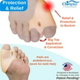 thumbnail image 4 of Chiroplax Bunion Corrector Relief Cushion Pads Guard Toe Separator Straightener Splint Protector Shield Spacer Sleeve Cover Hallux Valgus (4 Pads w/ Shims, Large), 4 of 7