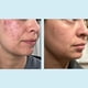 thumbnail image 3 of Gel Peel Perfect Image Ácido glicólico 50% con retinol 30 ml, 3 of 9