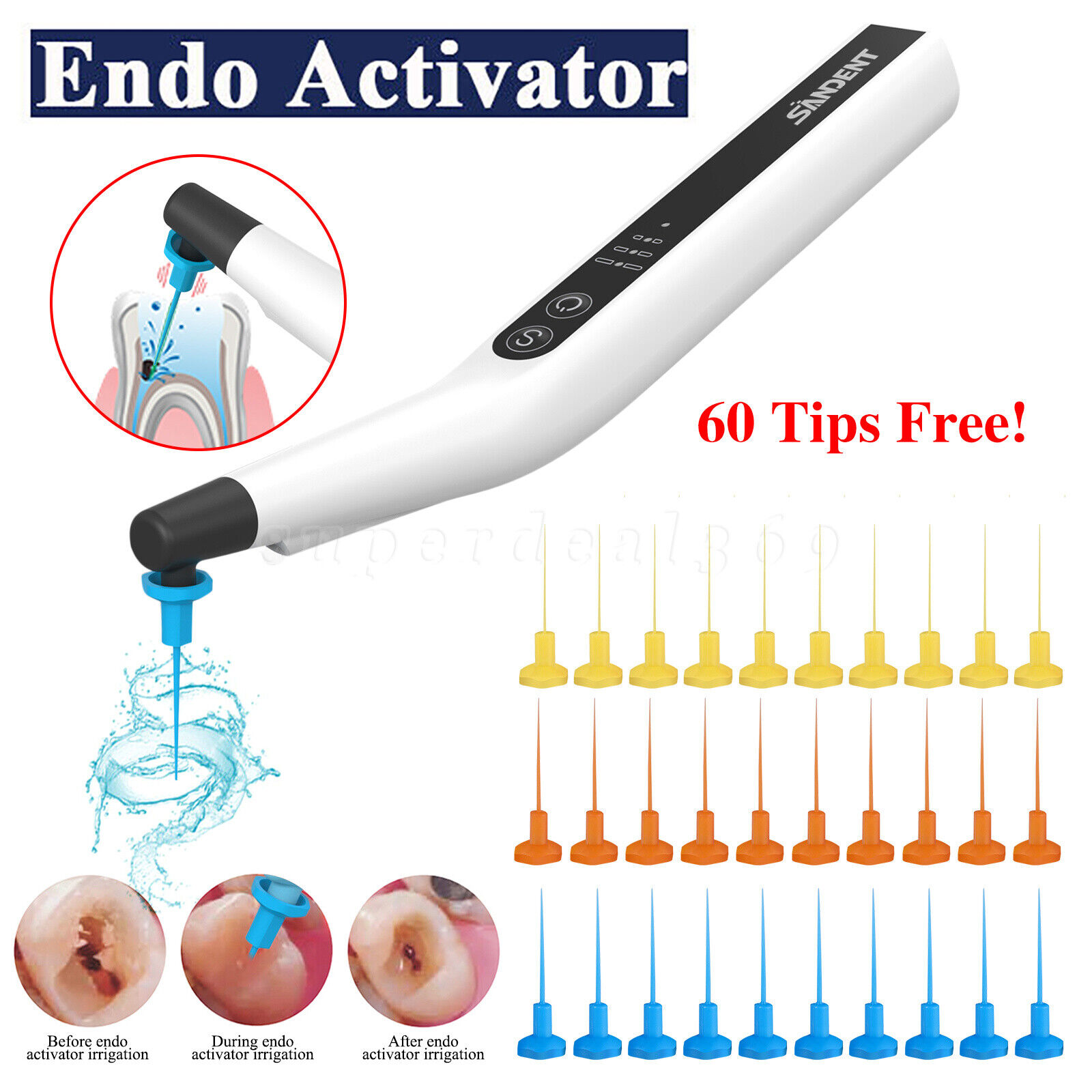 Dental Endo Activator Ultrasonic Endo Irrigator Root Canal Handpiece