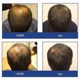 thumbnail image 2 of FOLIGAIN Stimulating Shampoo for Thinning Hair For Men with 2% Trioxidil (8oz) 236ml, 2 of 4