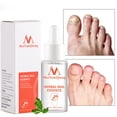thumbnail image 1 of Esencia para el cuidado de los pies de las uñas Gel para blanquear los pies de las uñas Ygjytge Cuidado Belleza, 1 of 8