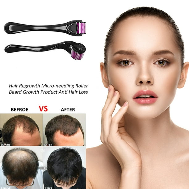 Professional Titanium ZGTS Derma Roller Needle For Face Care And Hair Loss  Treatment|Massage Roller| AliExpress | Professional Titanium Derma Roller  For Face Skin Care, And Hair Loss Treatment 