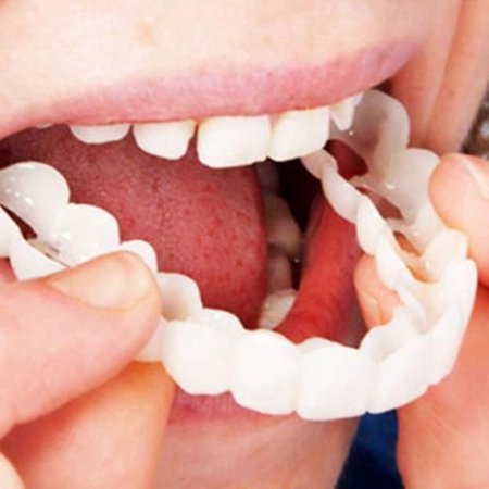 Adjustable Snap On Dentures, 1 Piece Smile Veneers