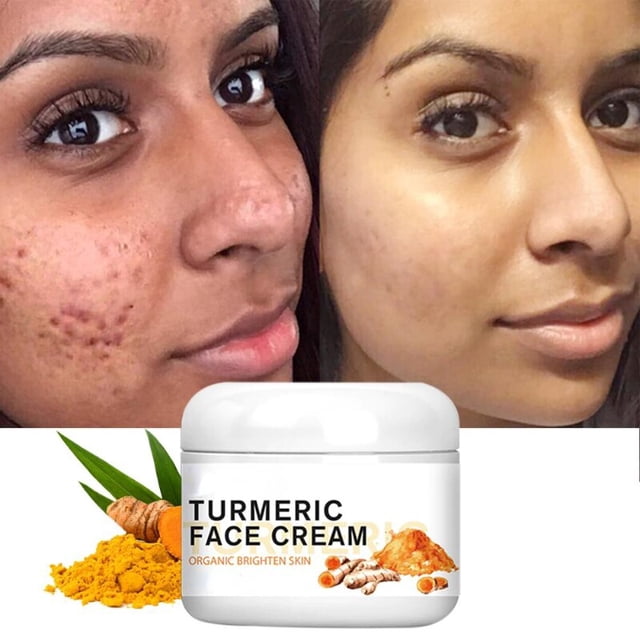 La Roche Posay-crema facial reparadora para el acné, Gel de ácido salicílico para eliminar espinillas y puntos negros, blanqueador de poros"Effaclar K" Fivean LED