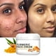 thumbnail image 1 of La Roche Posay-crema facial reparadora para el acné, Gel de ácido salicílico para eliminar espinillas y puntos negros, blanqueador de poros"Effaclar K" Fivean LED, 1 of 2