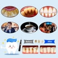 thumbnail image 3 of HLONK Plaque Remover for Teeth - Tartar Remover for Teeth  Dental Calculus Remover Teeth Cleaning Kit with LED Light & 3 Adjustable Modes Black, 3 of 7