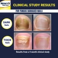 thumbnail image 5 of Gel aclarador de uñas con hongos NONYX, 120 ml, mejora al 90% las uñas de los pies, 5 of 5
