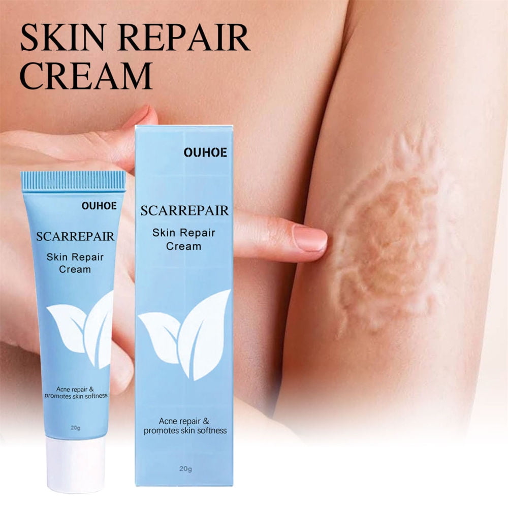 20g Medical Grade Scar Lotion Safe Ingredients Scar Repair Cream for