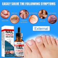 thumbnail image 2 of Nail Repair Liquid Hand And Foot Grey- Nail Care Repairing The Thickened Soft Nail Of Grey- Nail Liquid 30ml, 2 of 5