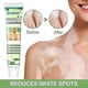 thumbnail image 1 of Crema de tratamiento White Tag para reducir las manchas blancas en la piel Vitiligo Skin Care_c, 1 of 1