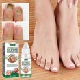 thumbnail image 3 of 1-3X 2024 New Essential Oil Nail Fungus Repair Liquid Nail Thickening Discoloration Off Soft Nail Thickening Type Onychomyc 20ml, 3 of 5