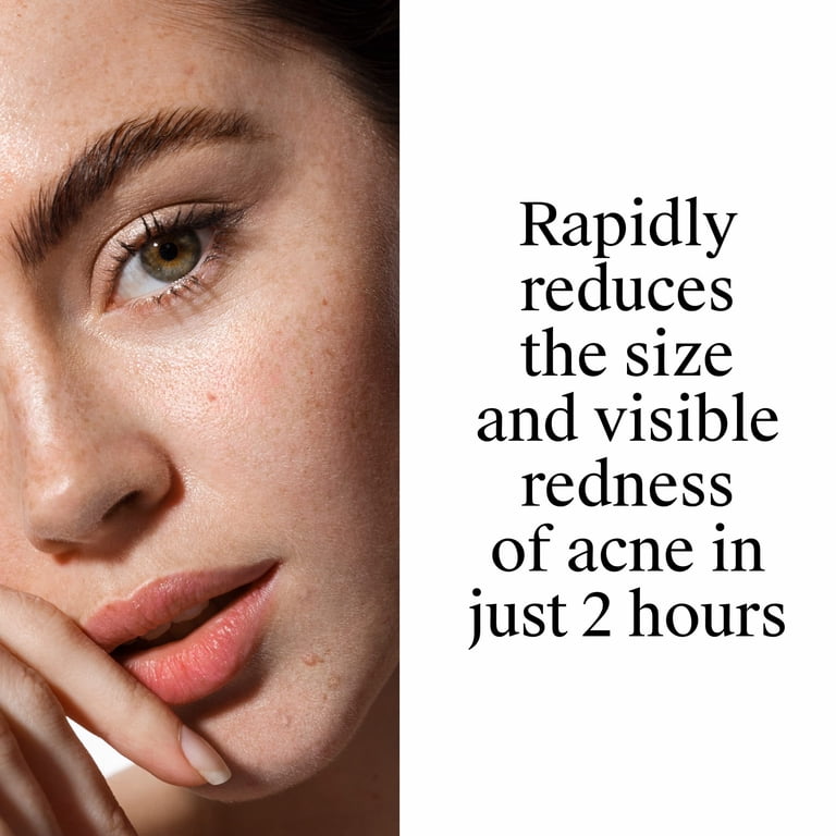 Neutrogena Rapid Clear Acne Spot Treatment, 10% Benzoyl Peroxide photo 6