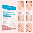 thumbnail image 5 of Ingredients And Effective Remover Tag 108PCS Removal Tag And Skin Improved Patch-Skin Removal Patches, Quick and Effective Removal Sticker for All Kinds of Skin, Friendly to New-User,Patch,1pack, 5 of 8