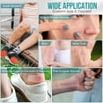 thumbnail image 4 of Medical Grade Hydrocolloid Roll for Wound Care, Adhesive Hydrocolloid Bandages, Waterproof Pimple Patch Roll, Ultra Absorbent Large Hydrocolloid Patch for Acne,Blisters and Minor Cuts, 4 of 8