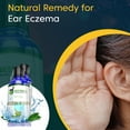 BM226 Eczema of Ears Natural Remedy