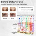 thumbnail image 3 of Mascarilla facial LED con terapia de luz roja y azul para el cuidado de la piel en casa, 3 of 7