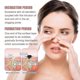thumbnail image 3 of Mascarilla nasal para eliminar puntos negros Qian Jaysuing que limpia profundamente los puntos negros y las espinillas |, 3 of 4