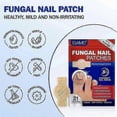 thumbnail image 4 of fungus nail patches for discoloured or ingrown nails, 4 of 5