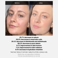 thumbnail image 2 of Sérum facial Medicube, exfoliante con un 21% de ácido (AHA+BHA), 2 of 3