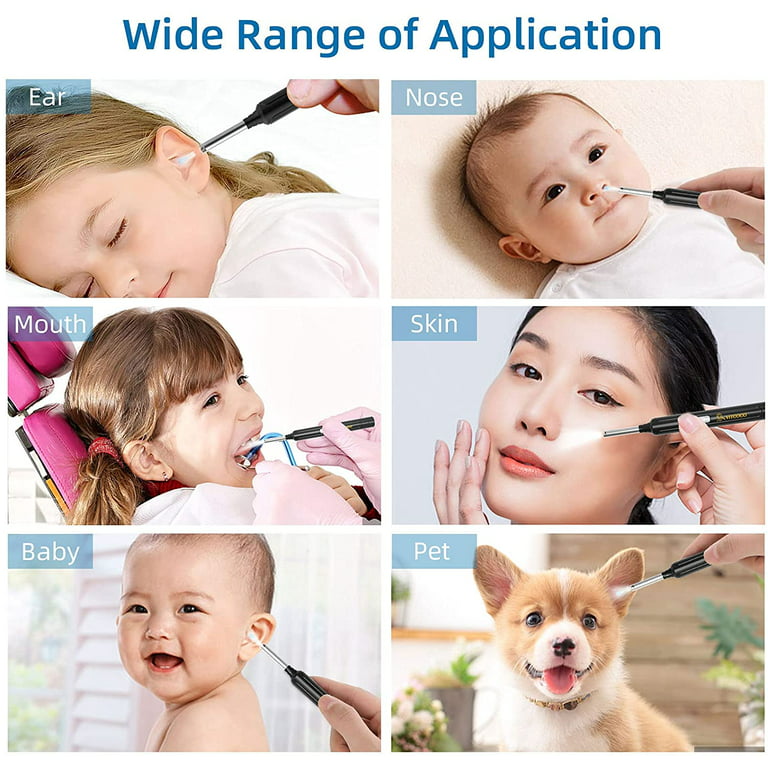 Wireless Otoscope Earwax Removal Tool For Adults Kids & Pets