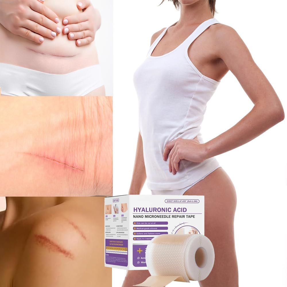 Risedora Hyaluronic Acid Nano Repair Tape, Silicone Scar Sheets and Face Tape for Wrinkles, Gentle Hydrating Scar Removal Tape for All Skin Types