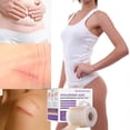 thumbnail image 3 of Risedora Hyaluronic Acid Nano Repair Tape, Silicone Scar Sheets and Face Tape for Wrinkles, Gentle Hydrating Scar Removal Tape for All Skin Types, 3 of 7