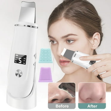 JUUTREN Skin Scrubber Face Spatula Skin Spatula Pore Cleaner Blackhead Remover Tools with 4 Modes, Ultrasonic Face Cleanser Blackhead Extractor for Deep Cleansing, 4 in 1 Facial Skin Care Tool