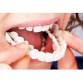 thumbnail image 3 of Carillas instantáneas JM Dentaduras postizas ajuste cómodo superior e inferior, 3 of 7