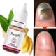 thumbnail image 4 of Ginger Nail Polish for Fungal Repair and Growth Promotion, 4 of 5