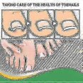 thumbnail image 5 of Pt Jaysuing Toenail Patch Nail Corrector Nail Repair Toe Ingrown Nails-, 5 of 5