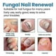 thumbnail image 4 of 3X Nail Repair Spray Repair And Clean Nails, Hands, Feet, Soft Nails, Thicken Nails, Polish Nails，100ml, 4 of 5