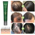 thumbnail image 4 of 1pc/2pcs 20ml Hair Growth Essential Oil Anti Hair Loss Fast Growth Prevent Hair Repair Care, 4 of 5