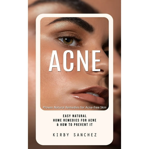 Acne: Proven Natural Remedies for Acne-free Skin (Easy Natural Home Remedies for Acne & How to Prevent It), (Paperback)