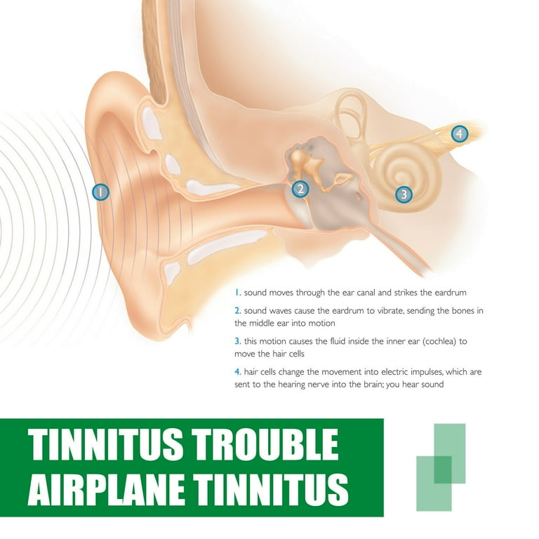Esmndop Tinnitus Relief for Ringing Ear Drops Ears Ear Ringing Relieving Ear Drops Tinnitus Ear Drops Ear Drops for Clogged Ears 20ml