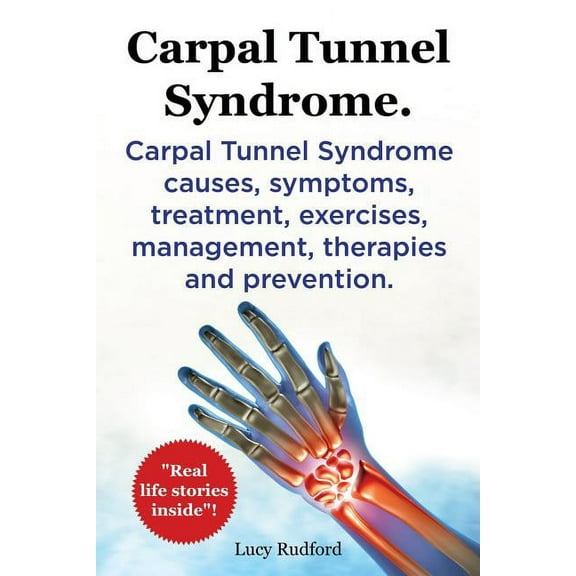 Carpal Tunnel Syndrome, Cts. Carpal Tunnel Syndrome Cts Causes, Symptoms, Treatment, Exercises, Management, Therapies and Prevention. (Paperback)