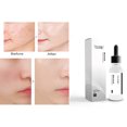 thumbnail image 1 of ligopéptido Reduce los poros Cara Elimina el acné Arrugas Esquí facial, 1 of 4