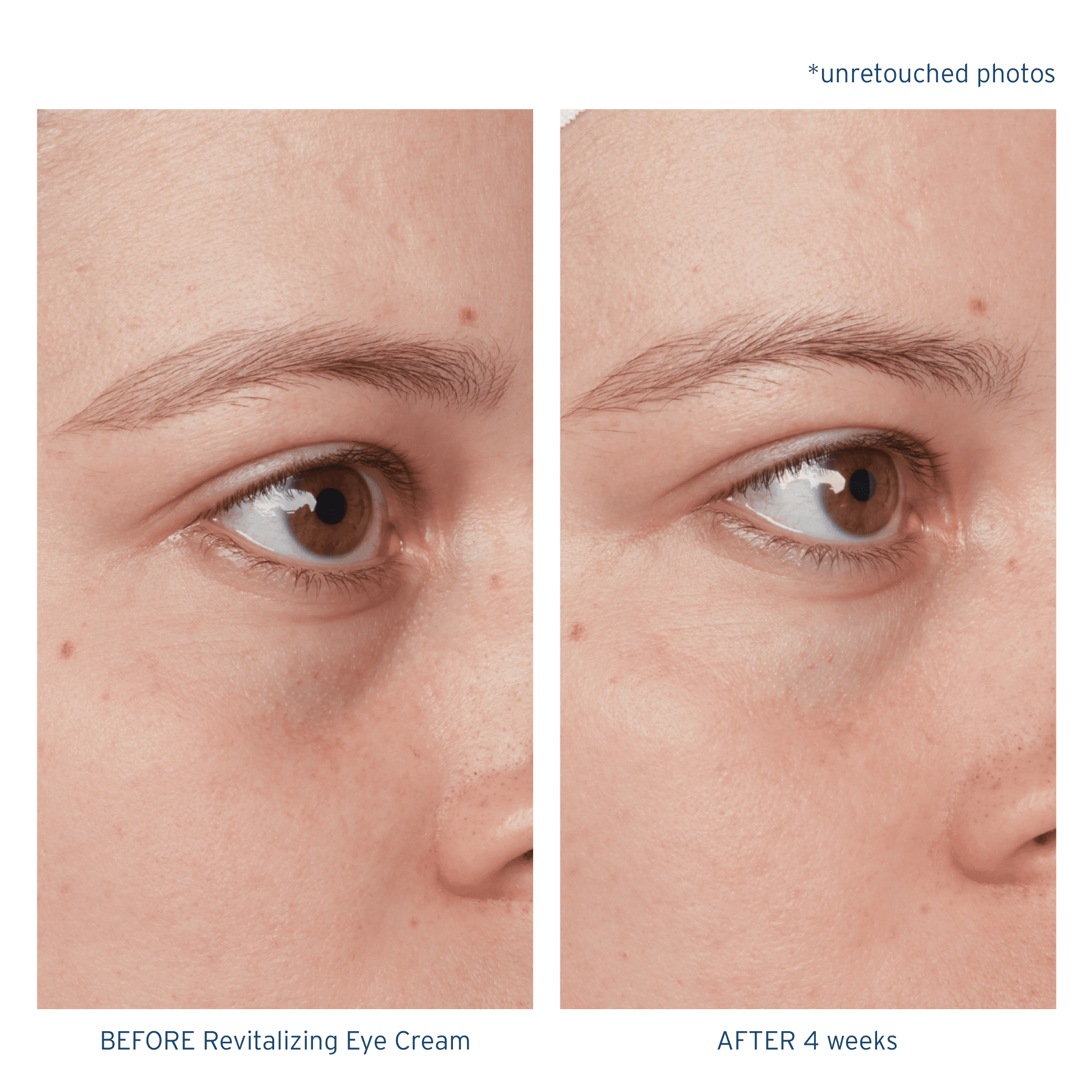 Santo Remedio, Piel Eterna, Revitalizing Eye Cream, Illuminating Eye Cream, Helps Reduce Dark Circles, Contains Marina Algae, Caffeine, Aloe, Hyaluronic Acid, Vitamin E, For All Skin Types, 1 Fl. Oz.