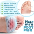 thumbnail image 3 of Paquete de 8 almohadillas metatarsianas para hombres y mujeres, almohadillas de silicona para pies para neuroma de Morton, callos, metatarsiano (azul) Sincero Electrónica, 3 of 5