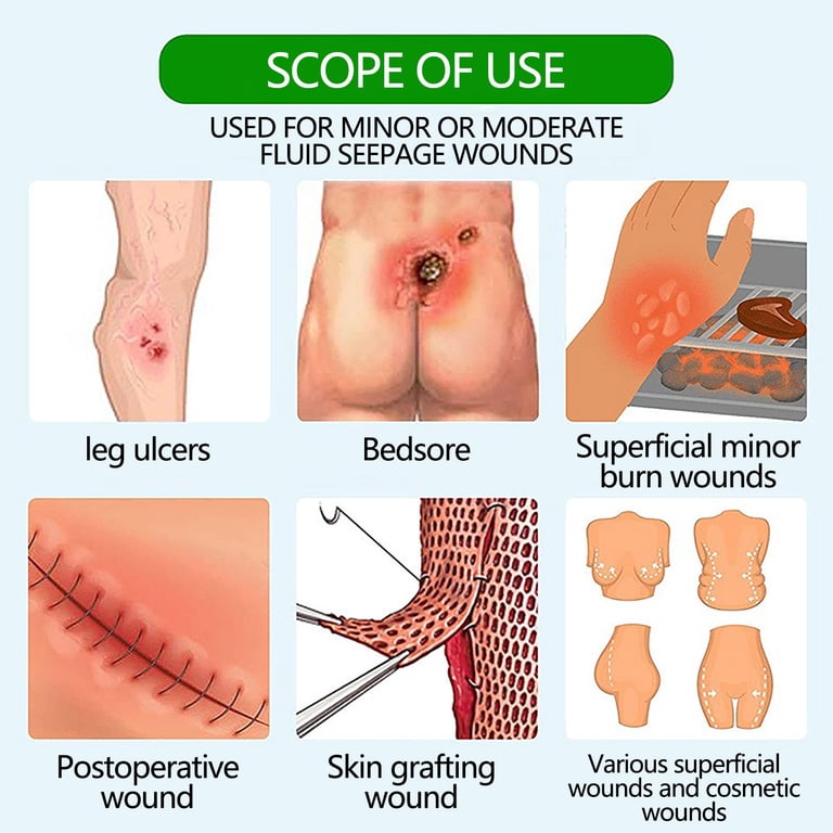 potrochi Wound Dressing Sacrum Foam Bandages Silicone Adhesive Border,  Waterproof Sacral Pads Absorbent Breathable Bed Sore Pressure Dressing, ...
