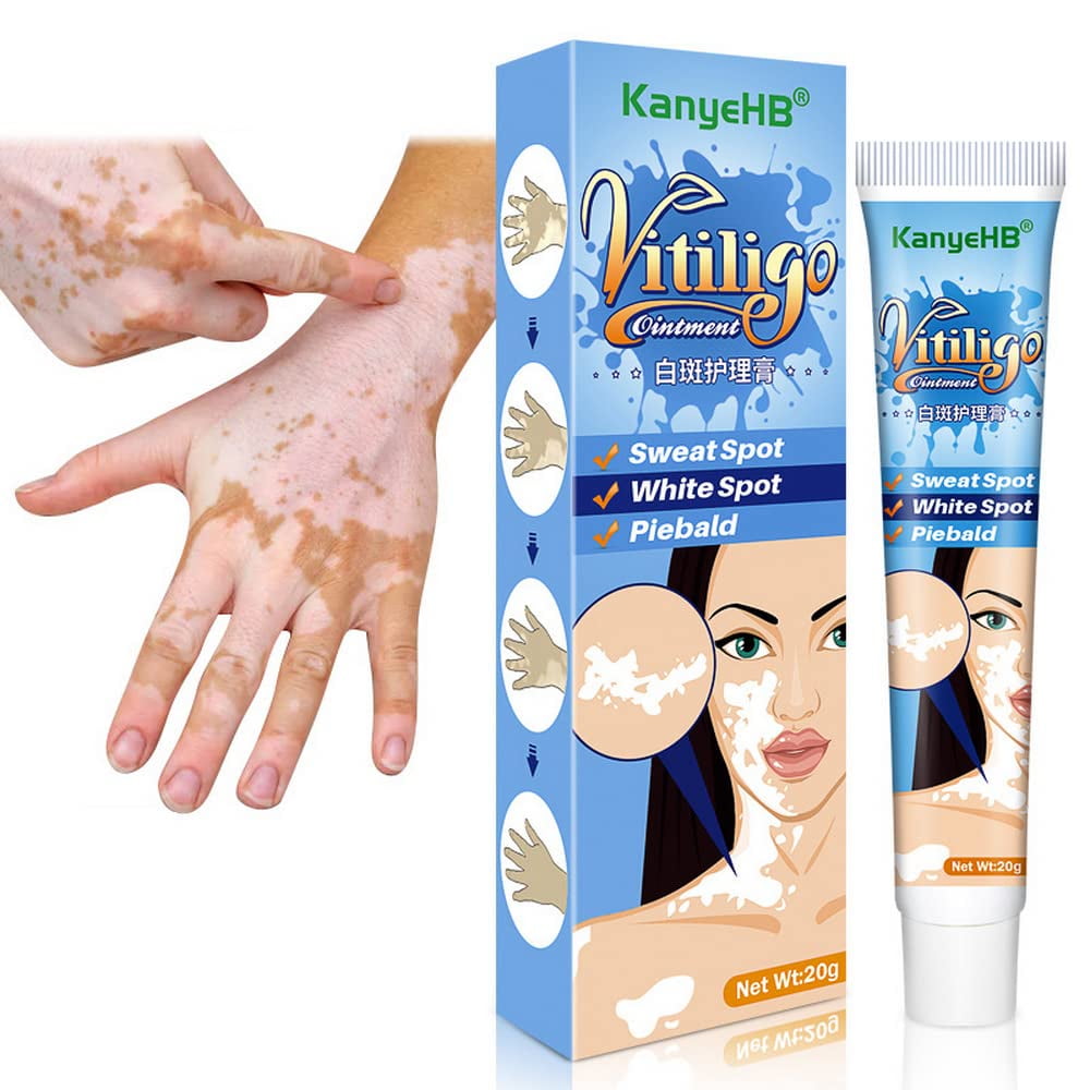 Vitiligo Cream, Vitiligo Treatment, Vitiligo Care Cream for Skin