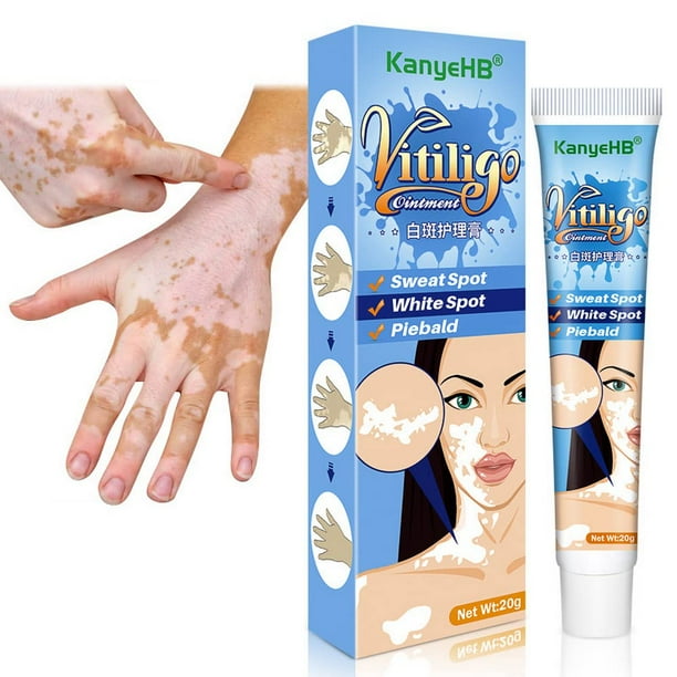 Vitiligo Cream, Vitiligo Treatment, Vitiligo Care Cream for Skin