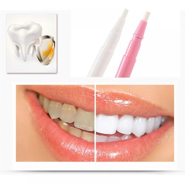 Everything about Used Snow Teeth Whitening Kit For Sale With Price